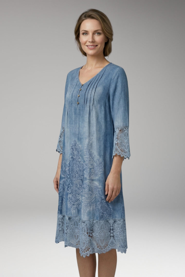Women’s Midi Dress with Button Neck and Lace Trim
